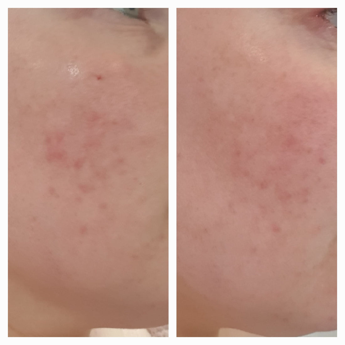 Customer Testimonial - Jen