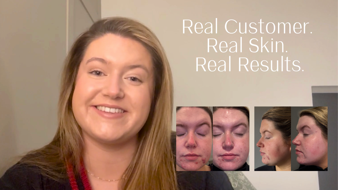 Real Results, Real Skin Krush Glow - Ava