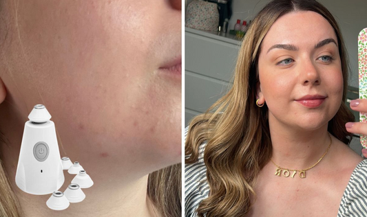 My skin was smoother and more youthful after using 1 skin tool for 6 weeks - Express.co.uk Feature