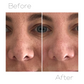 Microdermabrasion Kit - Limited Edition Pink